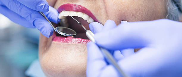 Best Emergency Wisdom Teeth Removal in Katy, TX